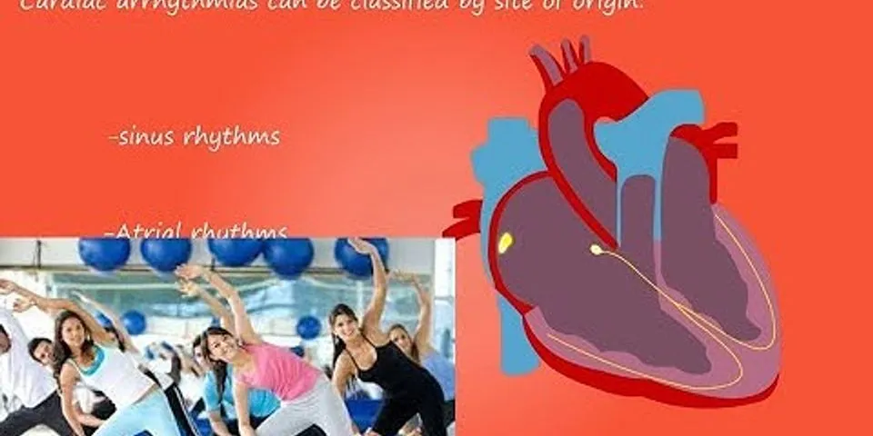 Olahraga untuk penderita aritmia jantung